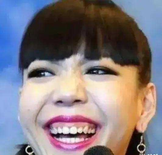 娱乐圈好看的嘴_凸嘴女星评价_大嘴女星时尚